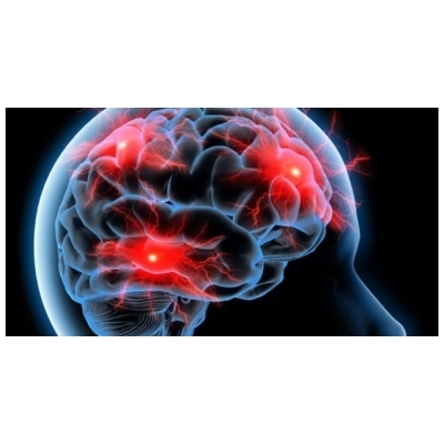 کمپین اطلاع رسانی "صدای سکته مغزی را بشنویم" تشکیل می شود.